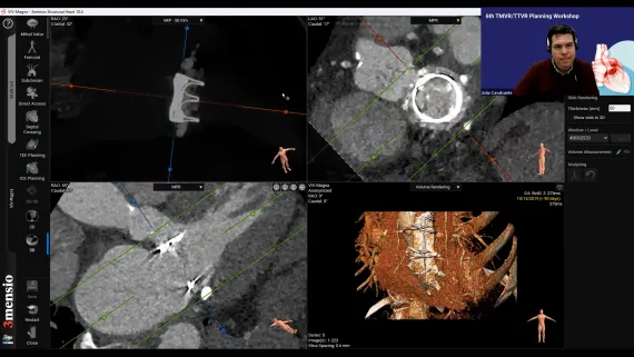 image from a previous TMVR/TTVR Planning Workshop