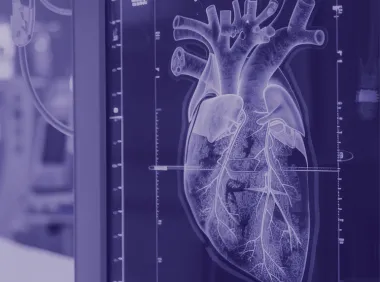 An image depicting a CT scan of the heart